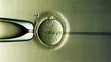 Die Neuregelung zur künstlichen Befruchtung ist Teil des Bioethik-Gesetzes.