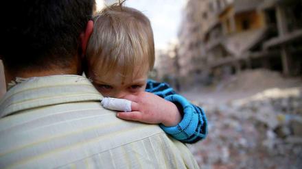 Ein verletztes syrisches Kind auf dem Arm eines Mannes in Damaskus