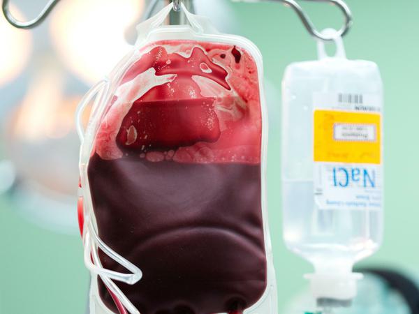 Eine Bluttransfusion könnte die Verjüngung fördern - sie birgt aber auch große Risiken.