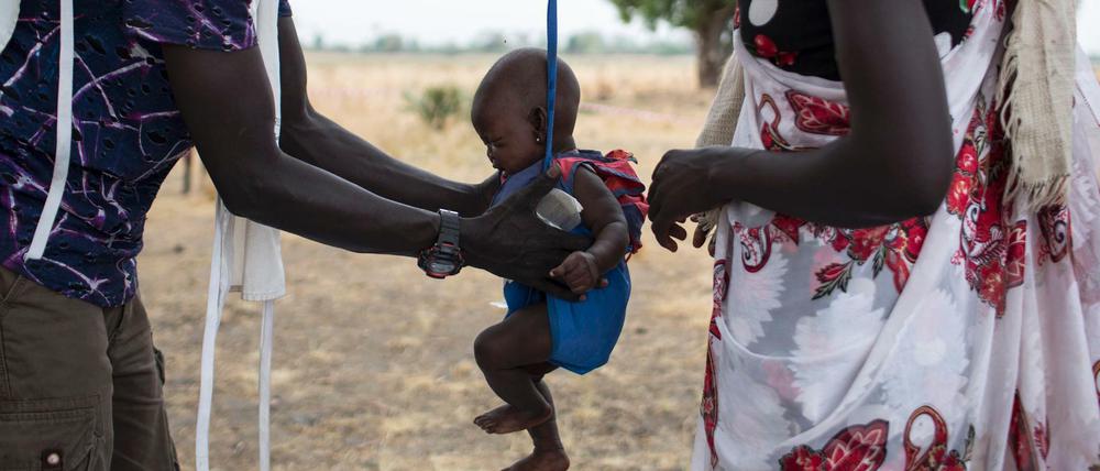 Ein unterernährtes Baby im Südsudan wird gewogen. Die Hilfsorganisation Ärzte ohne Grenzen versorgt dort viele Kinder mit Spezialnahrung. 