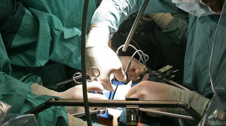 In einer deutschen Klinik wird bei einer Operation einem Spender eine Niere entnommen, die für eine Transplantation vorgesehen ist.