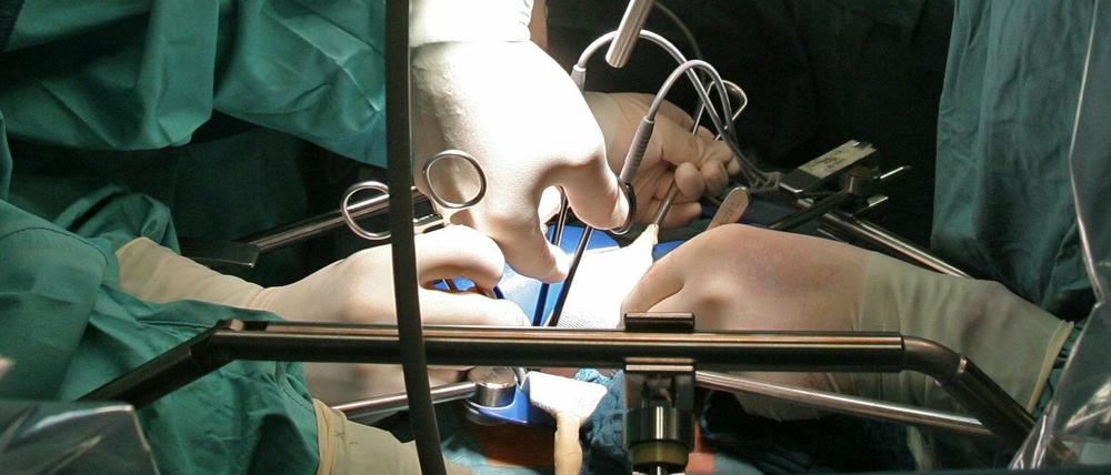 In einer deutschen Klinik wird bei einer Operation einem Spender eine Niere entnommen, die für eine Transplantation vorgesehen ist.