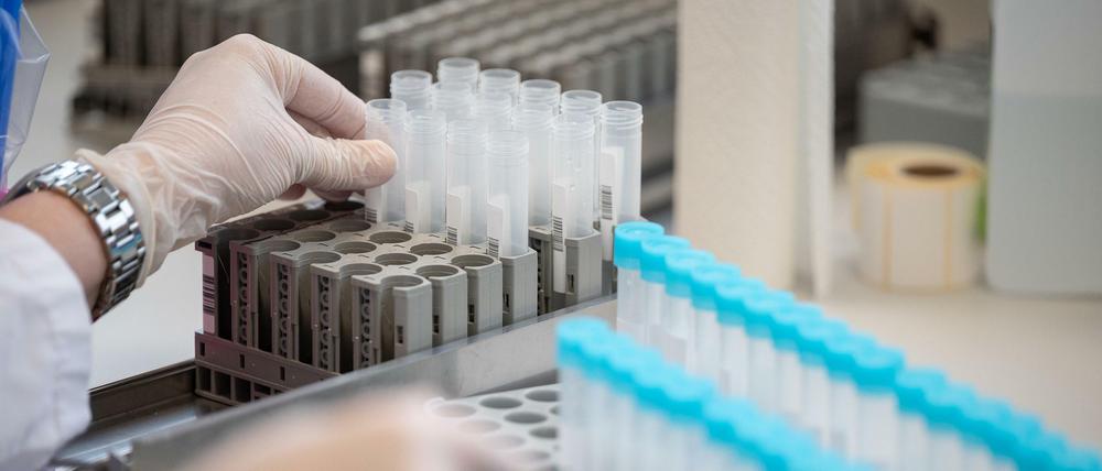 Eine Labormitarbeiterin bereitet in einem hessischen Labor Teströhrchen für einen PCR-Test vor.