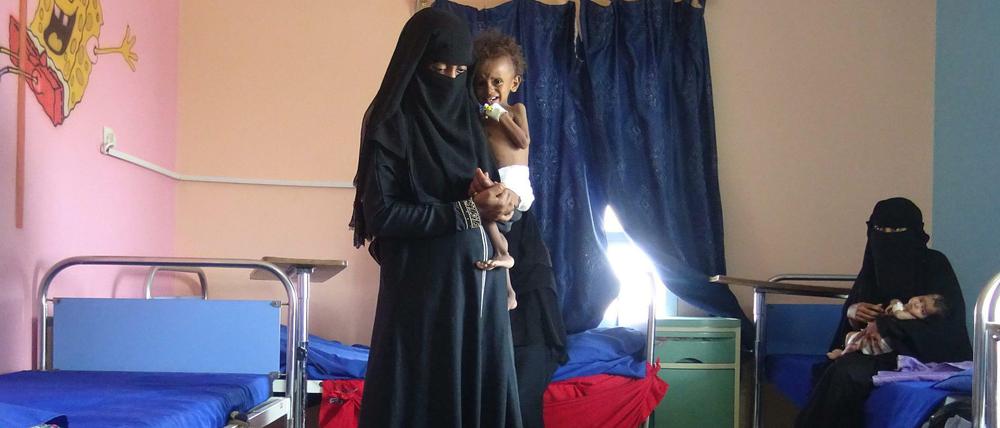 Lebensgefährlich unterernährt. Dieses jemenitische Kind ist fünf Jahre alt - und wiegt für sein Alter viel zu wenig. 