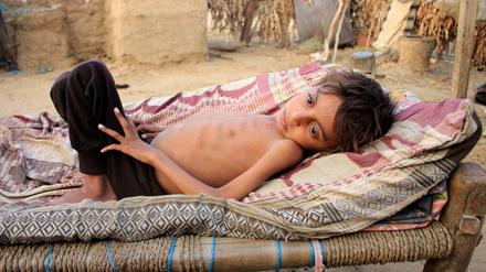 Ein unterernährter Junge im Jemen. 