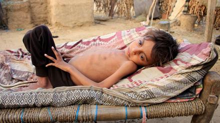 Millionen Kinder schweben in Lebensgefahr - sie hungern.