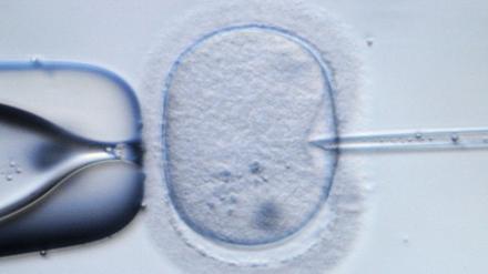 Entscheiden über das Leben: Hier wird eine menschliche Eizelle zu Demonstrationszwecken injiziert.