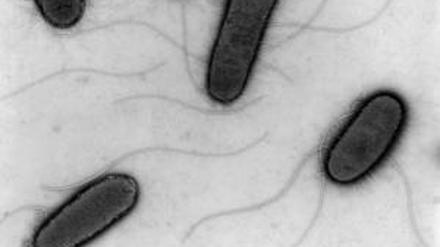 Mittels eines Elektronenmikroskops erstelltes Foto von EHEC-Bakterien. Archiv