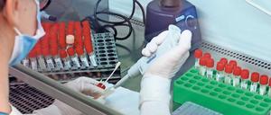 Analyse vor Ort. Das städtische Bergmann-Klinikum will künftig neben PCR-Tests auch Sequenzierungen positiver Proben auf Mutationen vornehmen.