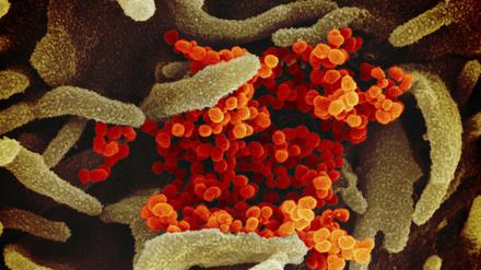 Eine undatierte elektronenmikroskopische Aufnahme des «U.S. National Institute of Health» zeigt das Coronavirus (SARS-CoV-2) (orange).