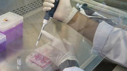Symbolbild: Ein Labortechniker extrahiert einen Teil eines sich in der Entwicklung befindlichen, möglichen Covid-19-Impfstoffs.