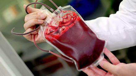 Blutkonserve. In Deutschland werden jeden Tag etwa 15000 Blutspenden benötigt.
