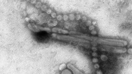 Pandemie-Kandidat. Das neue Vogelgrippevirus H7N9 unter dem Elektronenmikroskop.