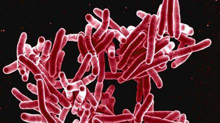 Bakterien der Art Mycobacterium tuberculosis rufen bei Menschen Tuberkulose hervor.