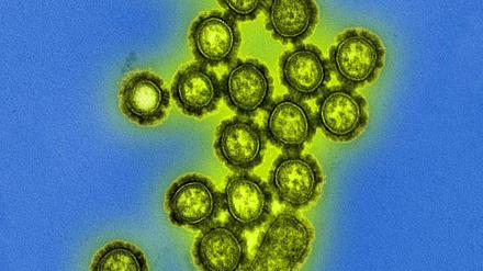 Influenza-Viren nutzen Proteine auf der Oberfläche (schwarz), um Zellen der Atemwege zu infizieren.