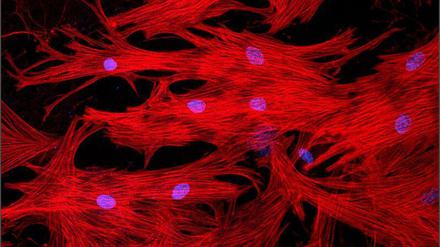 Herzmuskelzellen interagieren mit vielen anderen Zellen. Wie genau und welche das sind, das wollen Forscher jetzt untersuchen.