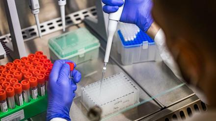 Neue Laborstudien und Ergebnisse aus Südafrika deuten auf milde Krankheitsverläufe bei Omikron-Infizierten hin.