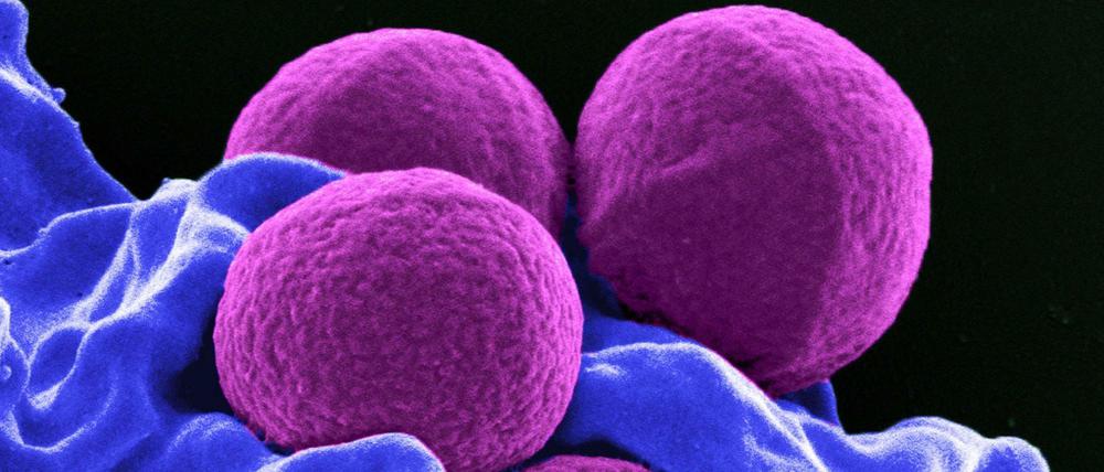 Vor 90 Jahren entdeckte Alexander Fleming das erste Antibiotikum - Penicillin. Gegen den Nachfolger Methicillin sind viele Mikroben (hier Staphylococcus aureus, lila) inzwischen resistent. 
