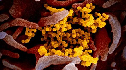 Elektronenmikroskopische Aufnahme von Sars-Cov-2-Körperchen (gelb), die sich von einer infizierten Zelle abschnüren. (angefärbt)