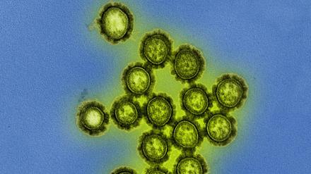 H1N1-Viren gehören zu einem der heute weltweit verbreiteten Stämmen von Grippe-erregenden Influanzaviren.