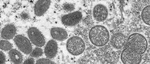 Reife, ovale Affenpockenviren (l) und kugelförmige unreife Virionen (r) (Archivfoto)