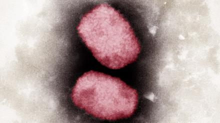 Elektronenmikroskopische Aufnahme von Affenpocken-Viren, koloriert