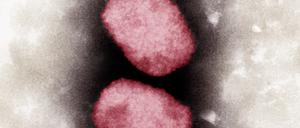 Elektronenmikroskopische Aufnahme von Affenpocken-Viren, koloriert