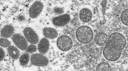 Diese elektronenmikroskopische Aufnahme aus dem Jahr 2003 zeigt reife, ovale Affenpockenviren aus einer menschlichen Hautprobe. 