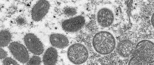 Diese elektronenmikroskopische Aufnahme aus dem Jahr 2003 zeigt reife, ovale Affenpockenviren aus einer menschlichen Hautprobe. 