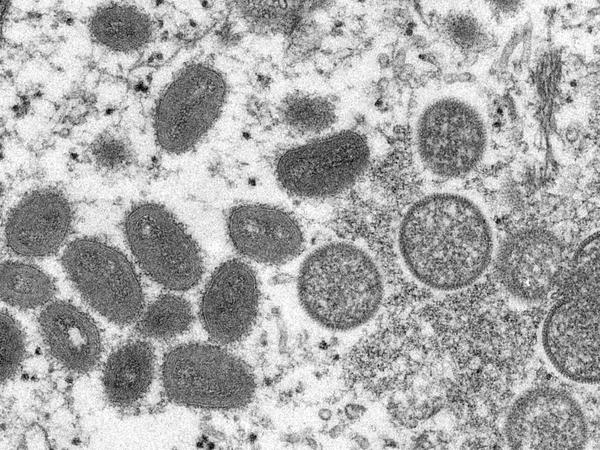 Diese elektronenmikroskopische Aufnahme zeigt reife, ovale Affenpockenviren (l) und kugelförmige unreife Virionen (r).