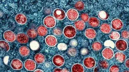 Eine kolorierte transmissionselektronenmikroskopische Aufnahme von Partikeln des Affenpockenvirus (rot) in einer infizierten Zelle (blau).