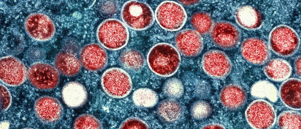 Eine mikroskopische Aufnahme von Partikeln des Affenpockenvirus in einer infizierten Zelle.
