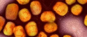 Eine kolorierte transmissionselektronenmikroskopische Aufnahme von Partikeln des Affenpockenvirus (Symbolbild).