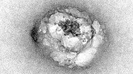 Diese elektronenmikroskopische Aufnahme eines Hepatitis-C-Virus wurde im Jahr 2016 als erstes Bild des Erregers von Forschenden des französischen Nationalen Instituts für Gesundheit und medizinische Forschung (Inserm) veröffentlicht.