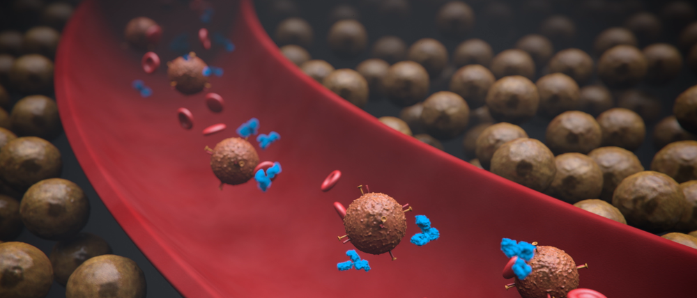 Checkpoint-Inhibitoren (blau) und T-Abwehrzellen (braun) gelangen über den Blutstrom (gezeigt sind in rot auch Rote Blutkörperchen) zu Tumoren.