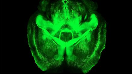 Das ganze Bild. Durch die grüne Färbung werden nicht nur die groben Strukturen des Gehirns sichtbar. Forscher können selbst die Verbindungen zwischen einzelnen Nervenzellen nachverfolgen.
