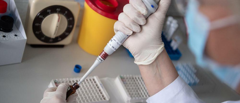 Blut wird in einem Labor auf Coronavirus-Antikörper untersucht.