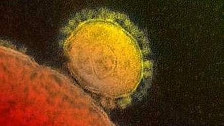 Das neue Coronavirus Mers
