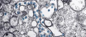 Sars-CoV-2-Viren (blau) sehen im Transmissionselektronenmikroskop heute noch so aus wie beim ersten Covid-19-Patienten in den USA. Doch das Erbgut der Erreger im Inneren der Virushülle verändert sich stetig. 
