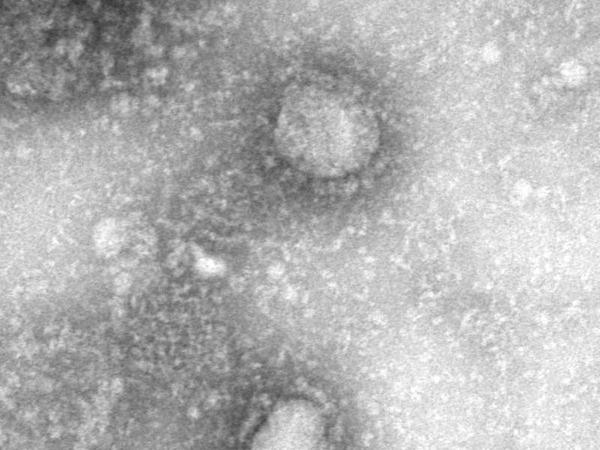 Das Bild zeigt den neuen Stamm des Coronavirus 2019-nCoV.