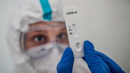 Ein Mediziner prüft einen IgG-/IgM-Schnelltest zum COVID-19-Antikörper-Nachweis.