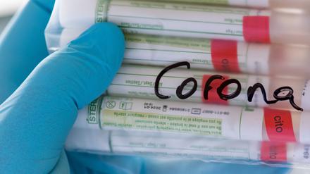 Proben für Corona-Tests werden im Diagnosticum-Labor im sächsischen Plauen für die weitere Untersuchung vorbereitet.