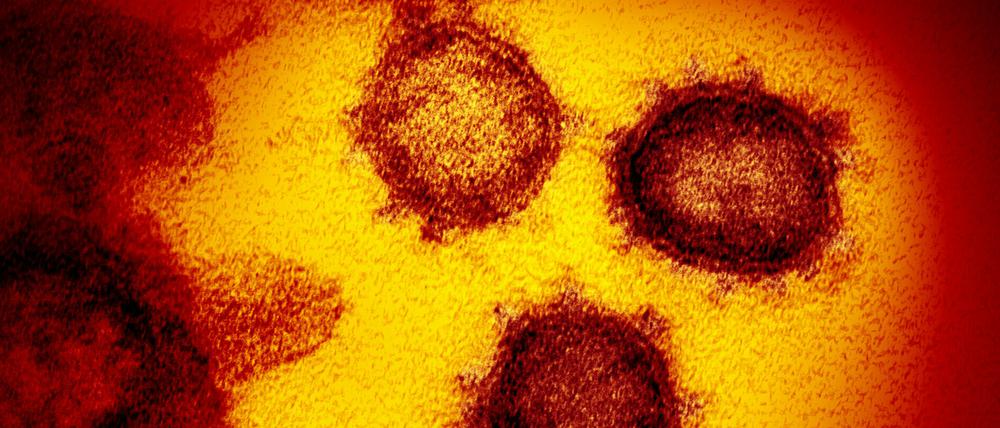 Mit steigender Zahl von Genesenen findet das Coronavirus immer weniger Empfänger.