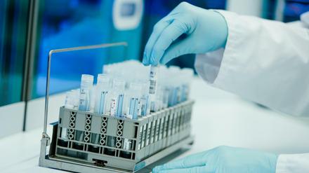 Ein Mitarbeiter wertet in einem Labor mehrere PCR-Tests aus.