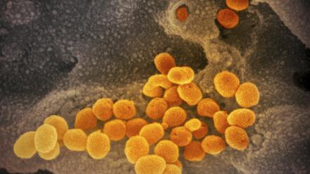 Interferon scheint in Kombination mit antiviralen Medikamenten in Zellkulturen hochwirksam gegen das Coronavirus zu sein. 