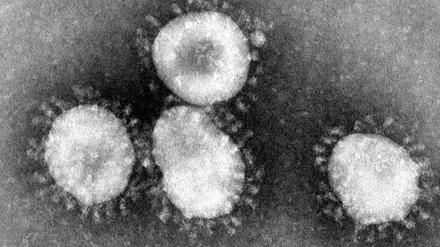 Vier Exemplare eines Coronavirus unter dem Elektronen-Mikroskop (anderer Typ als der jetzt entdeckte, Aufnahme vom April 2003). Die Ausbreitung einer bislang mysteriösen Lungenkrankheit in der zentralchinesischen Metropole Wuhan könnte auf ein neuartiges Coronavirus zurückgehen. 