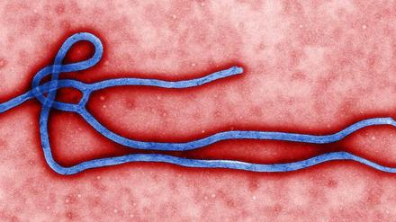 Das Bild zeigt ein Ebola-Virus.