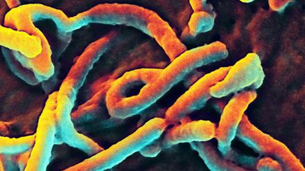 Ebolaviren unter dem Elektronenmikroskop.