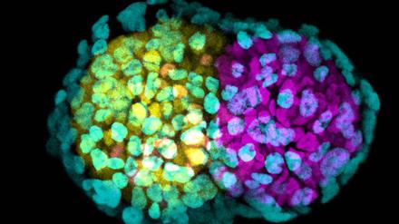 Aus Stammzellen können Forscher frühe Stadien von Embryonen züchten, die sich fast schon wie natürliche Embryonen entwickeln. Was (wie hier) noch von Mausstammzellen stammt, ist wohl bald auch mit menschlichen möglich.