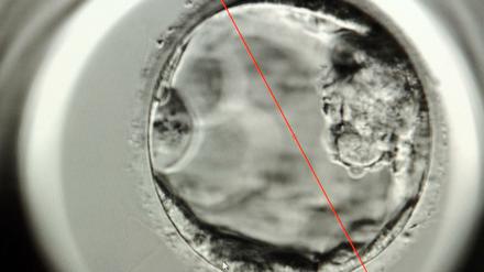 Ganz am Anfang. Auf dem Bildschirm ist ein fünf Tage alter menschlicher Embryo zu sehen.